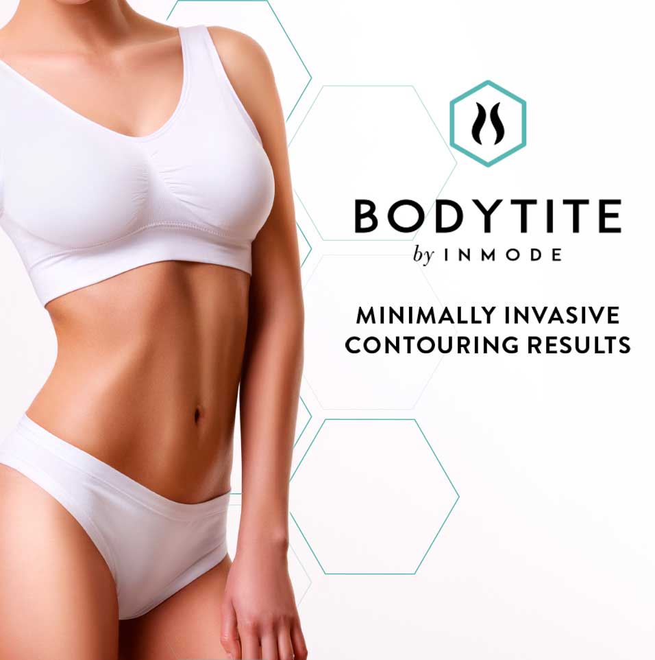 Bodytite y la retracción de la piel